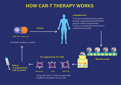 How CAR-T therapy works.